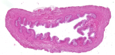 Vejiga urinaria