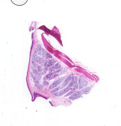 Glándula sublingual