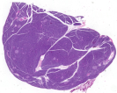 Pancreas