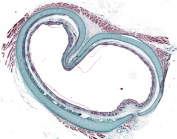 Oreja