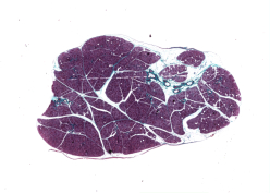 Glándula salival
