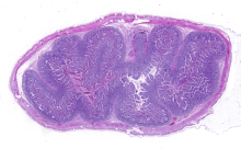 Intestino