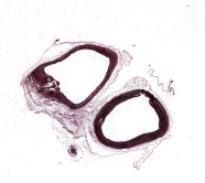 Aorta