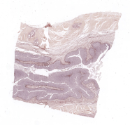 Colon