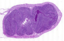 Intestino