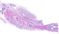 Recto longitudinal