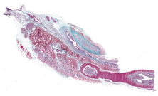 Recto longitudinal