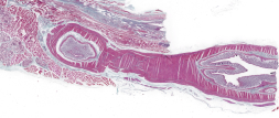 Recto longitudinal