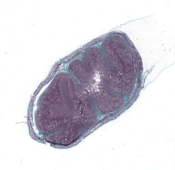 Intestino