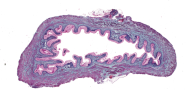 Vejiga urinaria