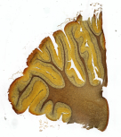 Cerebelo
