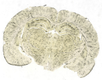 Cerebro