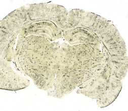 Cerebro