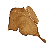 Cerebro, astrocitos