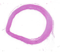 Aorta